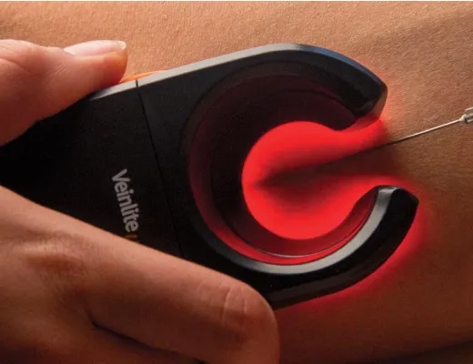 Épilation Laser/IPL